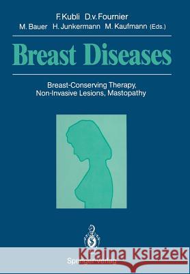 Breast Diseases: Breast-Conserving Therapy, Non-Invasive Lesions, Mastopathy Kubli, Fred 9783642735257 Springer - książka