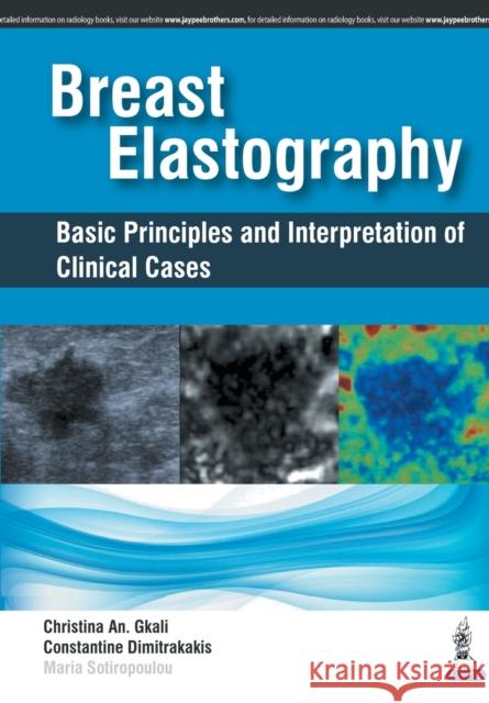 Breast Elastography: Basic Principles and Interpretation of Clinical Cases Christina An Gkali 9789352700578 Jp Medical Ltd - książka