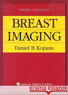 Breast Imaging Daniel B. Kopans 9780781747684 Lippincott Williams & Wilkins - książka