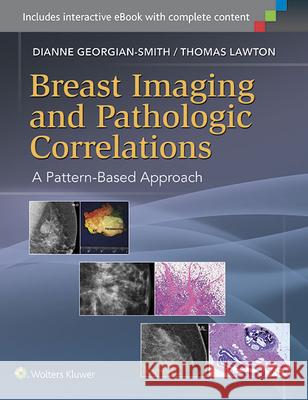 Breast Imaging and Pathologic Correlations: A Pattern-Based Approach Georgian-Smith, Dianne 9781451192698 Lippincott Williams & Wilkins - książka