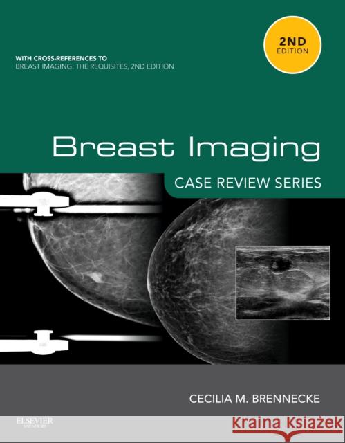 Breast Imaging: Case Review Series Cecilia Brennecke 9780323087223 SAUNDERS - książka