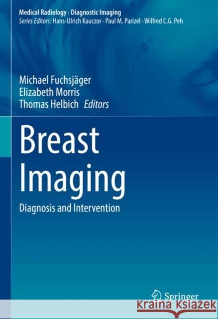 Breast Imaging: Diagnosis and Intervention Michael Fuchsj?ger Elizabeth Morris Thomas H. Helbich 9783030949174 Springer - książka