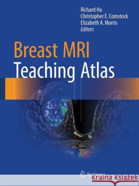 Breast MRI Teaching Atlas Richard Ha Elizabeth Morris 9781493964079 Springer - książka