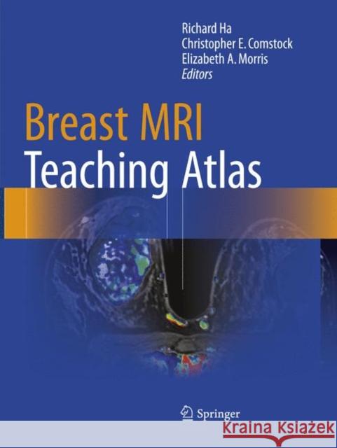 Breast MRI Teaching Atlas Richard Ha Christopher E. Comstock Elizabeth A. Morris 9781493981908 Springer - książka