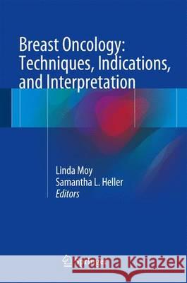 Breast Oncology: Techniques, Indications, and Interpretation Linda Moy Samantha L. Heller 9783319425610 Springer - książka