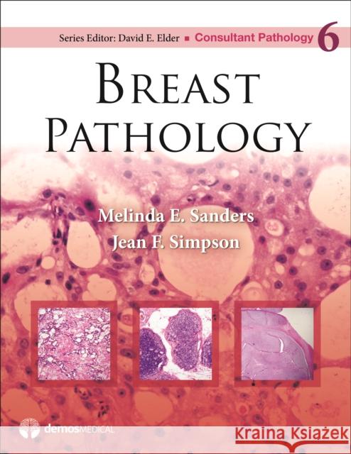 Breast Pathology Melinda E. Sanders Jean Simpson David Elder 9781936287680 Demos Medical Publishing - książka