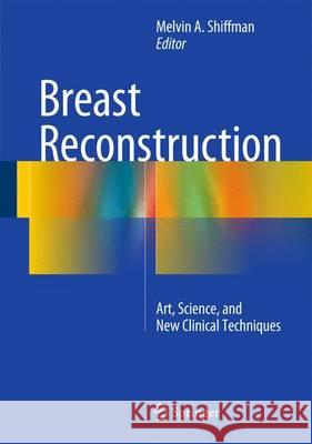 Breast Reconstruction: Art, Science, and New Clinical Techniques Shiffman, Melvin a. 9783319187259 Springer - książka