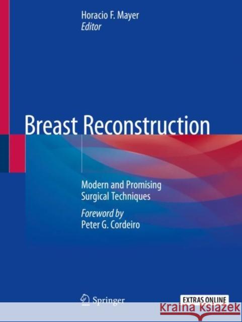 Breast Reconstruction: Modern and Promising Surgical Techniques Horacio F. Mayer 9783030346058 Springer - książka