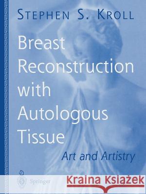 Breast Reconstruction with Autologous Tissue: Art and Artistry Kroll, Stephen S. 9781475781502 Springer - książka