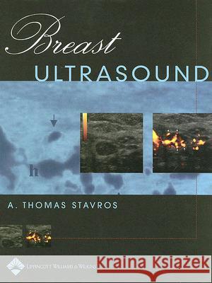 Breast Ultrasound A.Thomas Stavros 9780397516247  - książka