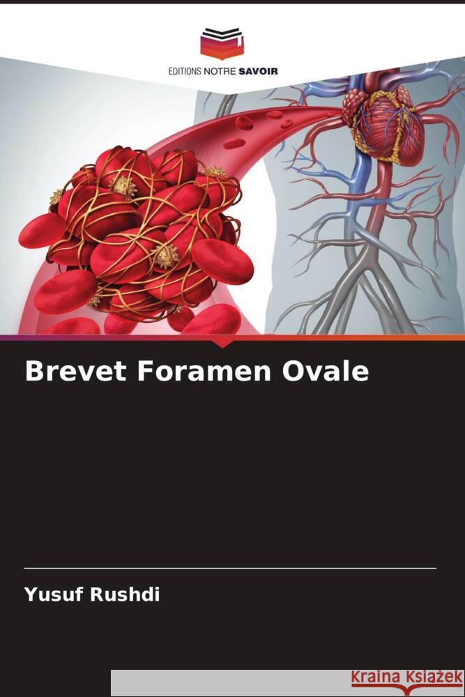 Brevet Foramen Ovale Rushdi, Yusuf 9786208238612 Editions Notre Savoir - książka