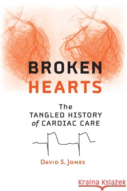 Broken Hearts: The Tangled History of Cardiac Care Jones, David S. 9781421415758 John Wiley & Sons - książka