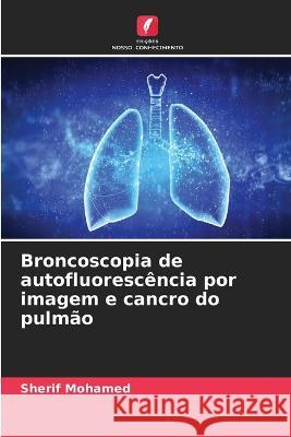 Broncoscopia de autofluoresc?ncia por imagem e cancro do pulm?o Sherif Mohamed 9786205696002 Edicoes Nosso Conhecimento - książka