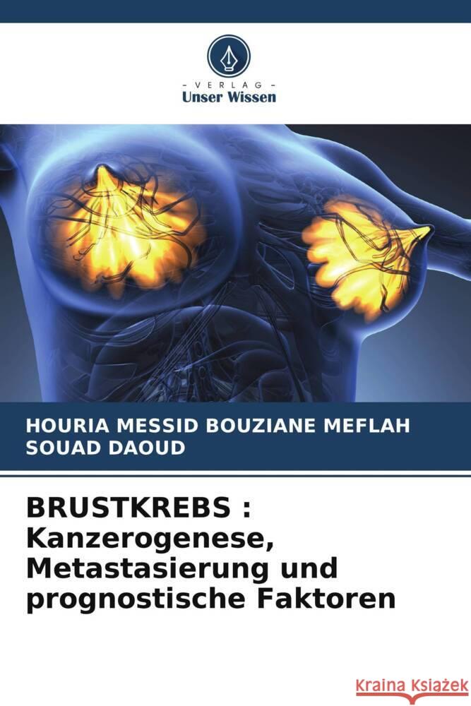 Brustkrebs: Kanzerogenese, Metastasierung und prognostische Faktoren Houria Messi Souad Daoud 9786206848073 Verlag Unser Wissen - książka