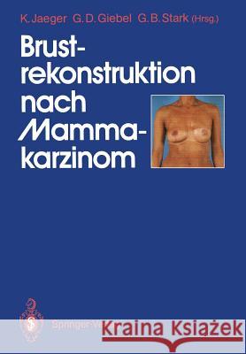 Brustrekonstruktion Nach Mammakarzinom Jaeger, Klaus 9783540519607 Not Avail - książka