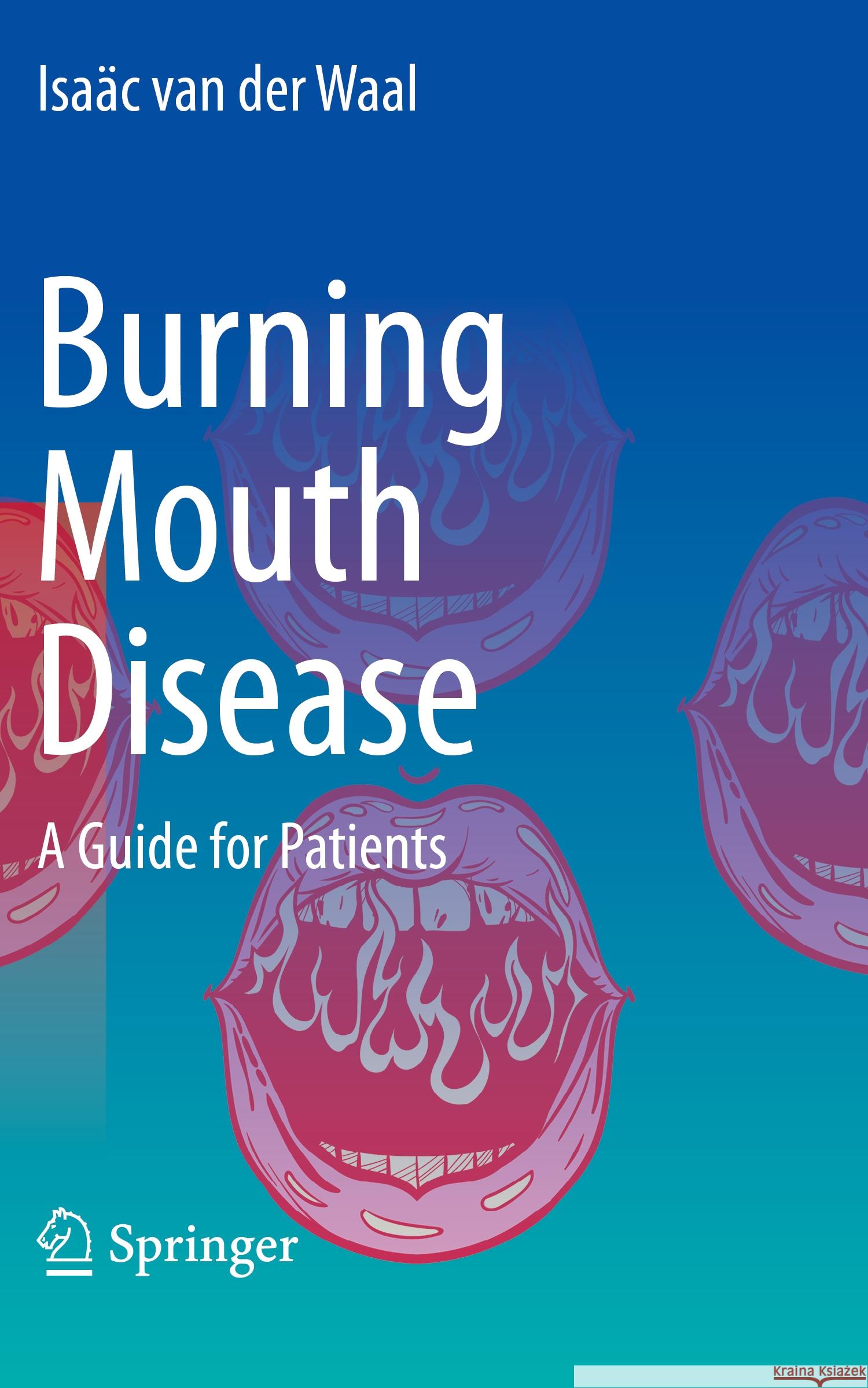 Burning Mouth Disease van der Waal, Isaäc 9783030942281 Springer International Publishing - książka