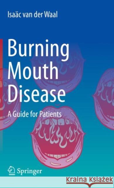 Burning Mouth Disease: A Guide for Patients Isaac van der Waal 9783030942250 Springer Nature Switzerland AG - książka
