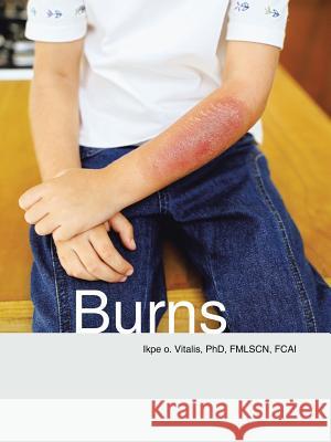 Burns Phd Fmlscn Vitalis, Fcai, Ikpe O.   9781482806977 Partridge Africa - książka