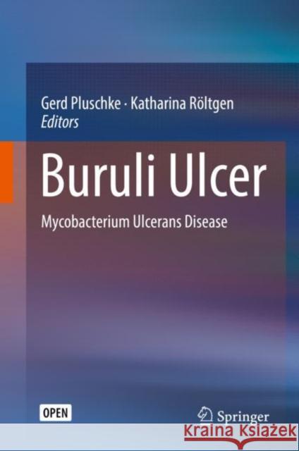 Buruli Ulcer: Mycobacterium Ulcerans Disease Pluschke, Gerd 9783030111137 Springer - książka