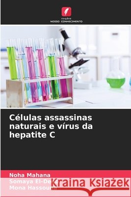 C?lulas assassinas naturais e v?rus da hepatite C Noha Mahana Somaya El-Deeb Mona Hassouna 9786209785054 Edicoes Nosso Conhecimento - książka