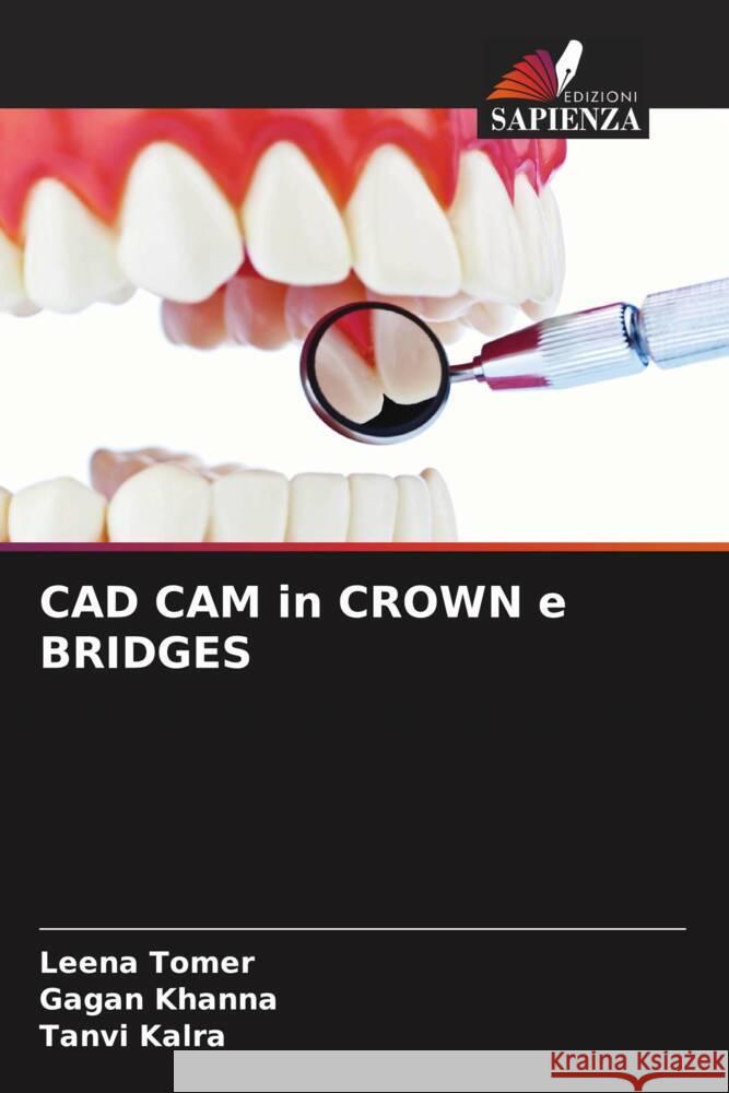 CAD CAM in CROWN e BRIDGES Leena Tomer Gagan Khanna Tanvi Kalra 9786207225033 Edizioni Sapienza - książka