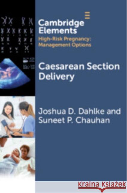 Caesarean Section Delivery Suneet P. (Gynecology & Reproductive Sciences at McGovern Medical School-UT Houston) Chauhan 9781009479479 Cambridge University Press - książka