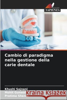Cambio di paradigma nella gestione della carie dentale Khushi Sajnani Mohit Gunwal Pratima Shenoi 9786630297973 Edizioni Sapienza - książka