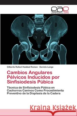 Cambios Angulares Pélvicos Inducidos por Sinfisiodesis Púbica Haddad Roman, Gilberto Rafael 9783659063404 Editorial Academica Espanola - książka