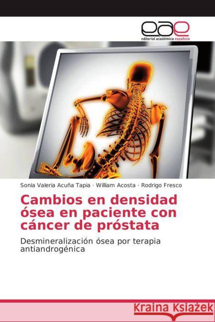 Cambios en densidad ósea en paciente con cáncer de próstata : Desmineralización ósea por terapia antiandrogénica Acuña Tapia, Sonia Valeria; Acosta, William; Fresco, Rodrigo 9783841764669 Editorial Académica Española - książka