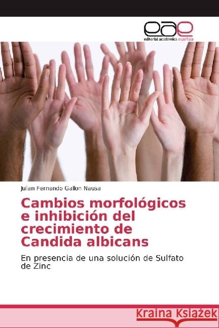 Cambios morfológicos e inhibición del crecimiento de Candida albicans : En presencia de una solución de Sulfato de Zinc Gallon Nausa, Julian Fernando 9783639605679 Editorial Académica Española - książka