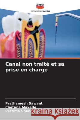 Canal non trait? et sa prise en charge Prathamesh Sawant Chetana Makade Pratima Shenoi 9786630356342 Editions Notre Savoir - książka
