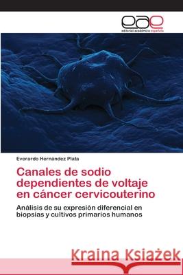 Canales de sodio dependientes de voltaje en cáncer cervicouterino Hernández Plata, Everardo 9783659070235 Editorial Academica Espanola - książka