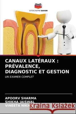 Canaux Latéraux: Prévalence, Diagnostic Et Gestion Sharma, Apoorv 9786203675238 Editions Notre Savoir - książka