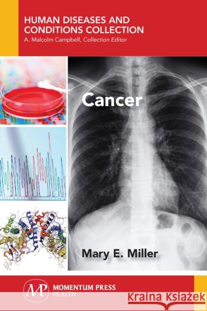 Cancer Mary E. Miller 9781944749859 Momentum Press - książka