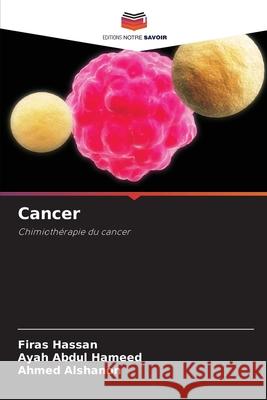 Cancer Hassan, Firas, Abdul Hameed, Ayah, Alshanon, Ahmed 9786209205224 Editions Notre Savoir - książka