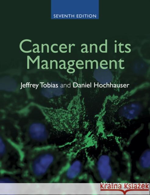 Cancer and Its Management Hochhauser, Daniel 9781118468739 Wiley-Blackwell - książka