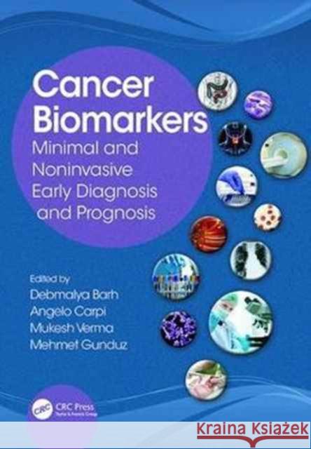 Cancer Biomarkers: Minimal and Noninvasive Early Diagnosis and Prognosis  9781138076808 Taylor and Francis - książka