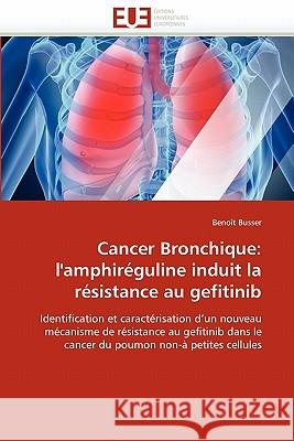 Cancer Bronchique: L'Amphiréguline Induit La Résistance Au Gefitinib Busser-B 9786131546075 Editions Universitaires Europeennes - książka