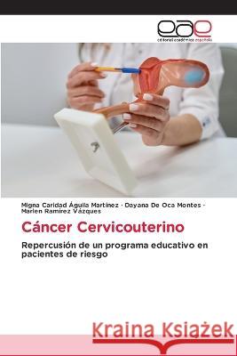 Cancer Cervicouterino Migna Caridad Aguila Martinez Dayana de Oca Montes Marlen Ramirez Vazques 9783659079320 Editorial Academica Espanola - książka