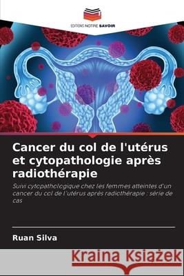 Cancer du col de l'ut?rus et cytopathologie apr?s radioth?rapie Ruan Silva 9786207740963 Editions Notre Savoir - książka