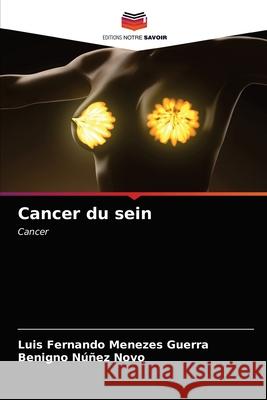 Cancer du sein Luis Fernando Menezes Guerra Benigno N 9786203482249 Editions Notre Savoir - książka