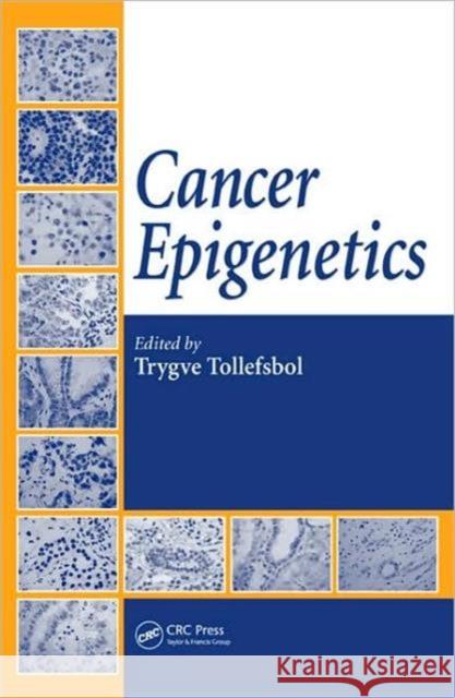 Cancer Epigenetics Trygve Tollefsbol 9781420045796 CRC - książka