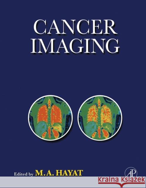 Cancer Imaging: Lung and Breast Carcinomas Hayat, M. A. 9780123704689 Academic Press - książka