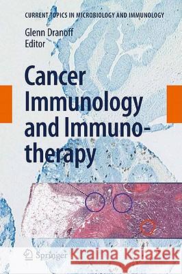 Cancer Immunology and Immunotherapy Glenn Dranoff 9783642141355 Springer-Verlag Berlin and Heidelberg GmbH &  - książka