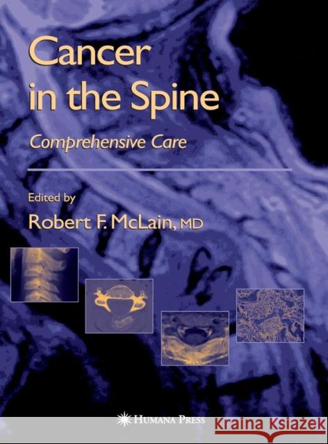 Cancer in the Spine: Comprehensive Care McLain, Robert F. 9781588290748 Humana Press - książka