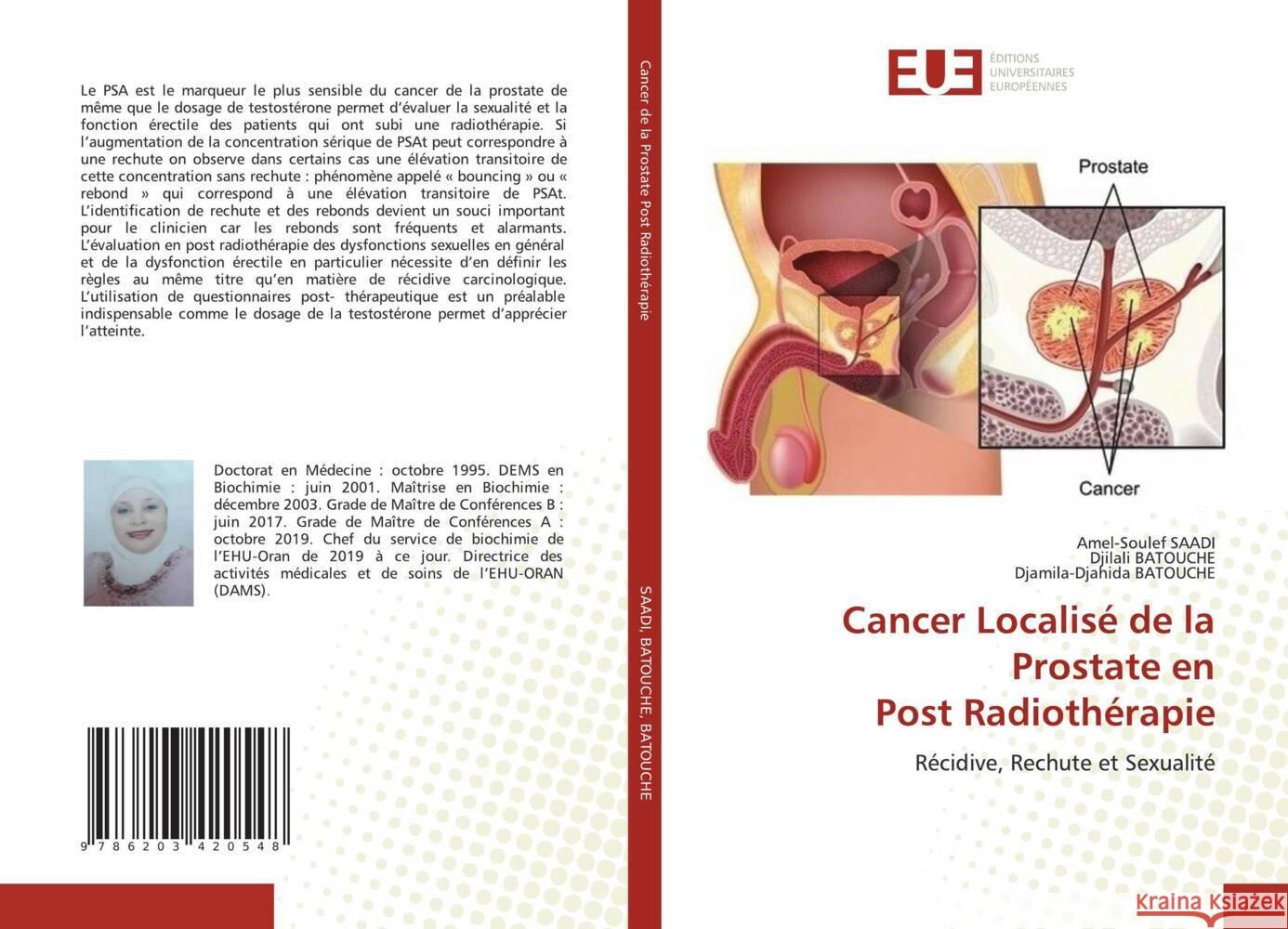 Cancer Localisé de la Prostate en Post Radiothérapie SAADI, Amel-Soulef, BATOUCHE, Djilali, Batouche, Djamila-Djahida 9786203420548 Éditions universitaires européennes - książka