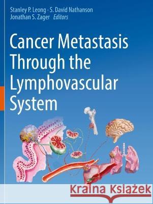 Cancer Metastasis Through the Lymphovascular System  9783030930868 Springer International Publishing - książka