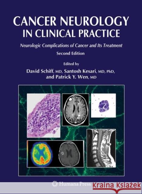Cancer Neurology in Clinical Practice: Neurologic Complications of Cancer and Its Treatment Schiff, David 9781588299833 Humana Press - książka