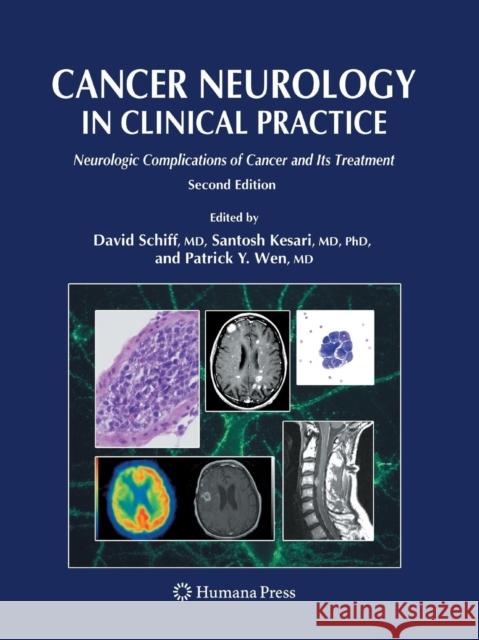 Cancer Neurology in Clinical Practice: Neurologic Complications of Cancer and Its Treatment Schiff, David 9781627039543 Humana Press - książka