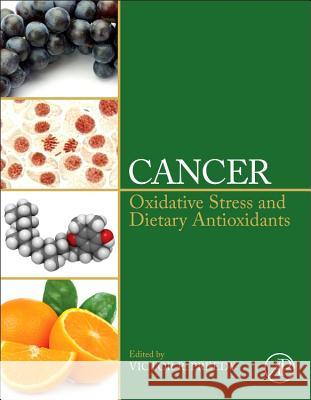 Cancer: Oxidative Stress and Dietary Antioxidants Preedy, Victor R. 9780124052055 ACADEMIC PRESS - książka